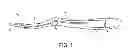 Fig. 02 - Oral care implement with liquid delivery system