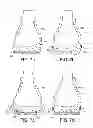 Fig. 07 - Injected footwear