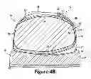 Fig. 07 - Article Of Footwear With Layered Fit System