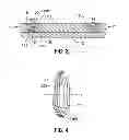 Fig. 04 - Wellbore packer back-up ring assembly, packer and method
