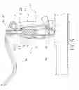 Fig. 06 - Hydraulic brake