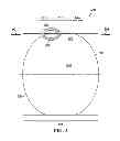Fig. 04 - Method of making a composite tank having joint with softening strip
