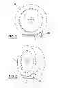 Fig. 02 - Anti-Snag Guiding Device For Hoses, Cables Or Other Flexible Longitudinal Elements
