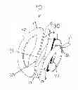 Fig. 01 - Balloon sealing and displaying device