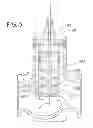 Fig. 04 - Valve trim assembly and flow control valve including the valve trim assembly