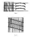 Fig. 07 - Apparatus for guiding a flexible member