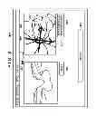Fig. 09 - Image processing apparatus, image processing apparatus control method, ophthalmologic apparatus, ophthalmologic apparatus control method, ophthalmologic system, and storage medium
