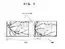 Fig. 07 - Ophthalmic apparatus, ophthalmic apparatus control method and storage medium