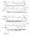 Fig. 02 - Diagnostic, prescriptive, and data-gathering system and method for macular pigment deficits and other eye disorders