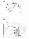 Fig. 02 - HEARING INSTRUMENT AND METHOD FOR MANUFACTURING A HEARING INSTRUMENT