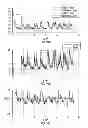Fig. 09 - Hearing aids with adaptive beamformer responsive to off-axis speech