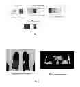 Fig. 02 - Method for sorting CT image slices and method for constructing 3D CT image