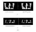 Fig. 04 - Method for sorting CT image slices and method for constructing 3D CT image