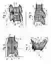 Fig. 03 - Vane assembly for an axial flow turbine