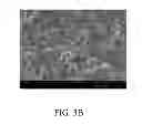 Fig. 07 - Surface Functionalized Colloidally Stable Spheroidal Nano-apatites Exhibiting Intrinsic Multi-functionality