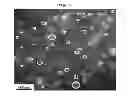 Fig. 02 - Method for treating and diagnosing cancer by using cell-derived microvesicles