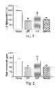 Fig. 02 - PHARMACEUTICAL COMPOSITIONS COMPRISING EPA AND A CARDIOVASCULAR AGENT AND METHODS OF USING THE SAME
