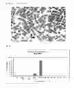 Fig. 08 - Method for the preparation of a pharmaceutical composition comprising 5-aminosalicylic acid for use in treatment of ulcerative colitis and Crohn's disease