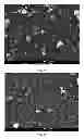 Fig. 02 - Particles of tetracyclines and protecting agent