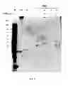 Fig. 16 - Amniotic membrane preparations and purified compositions and anti-angiogenesis treatment
