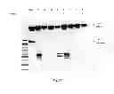 Fig. 20 - Amniotic membrane preparations and purified compositions and anti-angiogenesis treatment