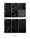 Fig. 23 - Amniotic membrane preparations and purified compositions and anti-angiogenesis treatment