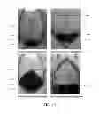 Fig. 08 - FLOW CELL DESIGN FOR UNIFORM RESIDENCE TIME FLUID FLOW
