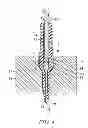Fig. 05 - Method of forming a spark plug