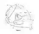Fig. 07 - SETTING INDICATOR FOR GOLF CLUB