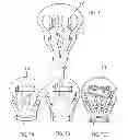 Fig. 06 - HAND SACK PADDLE APPARATUS