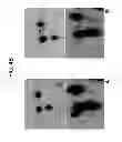 Fig. 07 - BIOMARKERS FOR DIAGNOSING AND DETECTING THE PROGRESSION OF NEURODEGENERATIVE DISORDERS, IN PARTICULAR OF AMYOTROPHIC LATERAL SCLEROSIS
