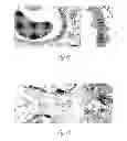 Fig. 07 - -acetyl mannosamine as a therapeutic agent
