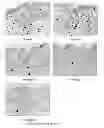 Fig. 01 - AGE PRODUCTION INHIBITOR