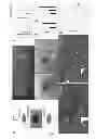Fig. 02 - Method for reducing expression of downregulated in renal cell carcinoma in malignant gliomas