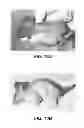 Fig. 17 - Composition and method for the enhancement of the efficacy of drugs