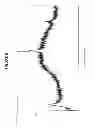 Fig. 06 - Salts of dexlansoprazole and their preparation