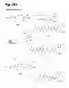Fig. 22 - Antiproliferative compounds, conjugates thereof, methods therefor, and uses thereof