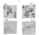 Fig. 08 - Removing Cells from an Organism