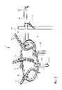 Fig. 08 - SURGICAL RETRACTOR WITH LIGHT
