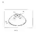 Fig. 02 - DEVICE AND METHOD FOR LIFTING ABDOMINAL WALL DURING MEDICAL PROCEDURE