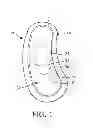 Fig. 02 - Disposable electrode for electro-stimulation