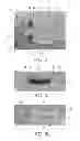 Fig. 03 - Disposable electrode for electro-stimulation
