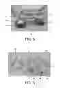 Fig. 05 - Disposable electrode for electro-stimulation