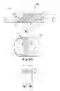 Fig. 02 - RADIOPAQUE MARKER FOR A CATHETER