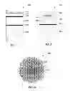 Fig. 03 - SYSTEMS AND METHODS FOR INTRAVASCULAR ULTRASOUND IMAGING
