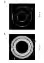 Fig. 06 - SYSTEMS AND METHODS FOR INTRAVASCULAR ULTRASOUND IMAGING