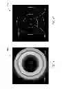 Fig. 08 - SYSTEMS AND METHODS FOR INTRAVASCULAR ULTRASOUND IMAGING