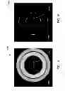 Fig. 09 - SYSTEMS AND METHODS FOR INTRAVASCULAR ULTRASOUND IMAGING