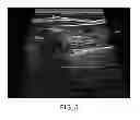 Fig. 06 - Automated pneumothorax detection