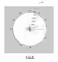 Fig. 07 - Automated pneumothorax detection